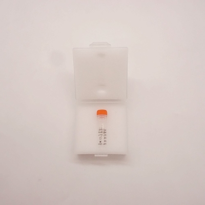 Fluorescência In Situ Reagente de hibridização CBFB Sonda separada de duas cores